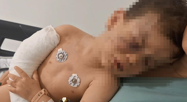2 yaşındaki çocuğa vahşeti yaşattı; çocuk yoğun bakımda, anne ile sevgilisi gözaltında