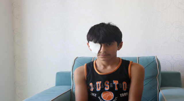 Yapıştırıcı sıçrayınca kapanan göz kapağı doktor müdahalesiyle açıldı
