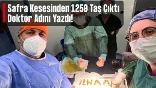 Safra kesesinden 1250 taş çıktı, doktor ismini yazdı