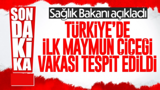 Türkiye'de ilk maymun çiçeği vakası tespit edildi