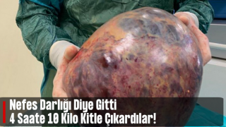 Sivas'ta nefes darlığı ile gittiği hastanede, karnından 10 kilo kitle çıkarıldı