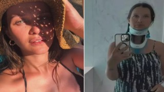 İrem Helvacıoğlu tatilde kaza geçirdi: Felç kaldım sandım